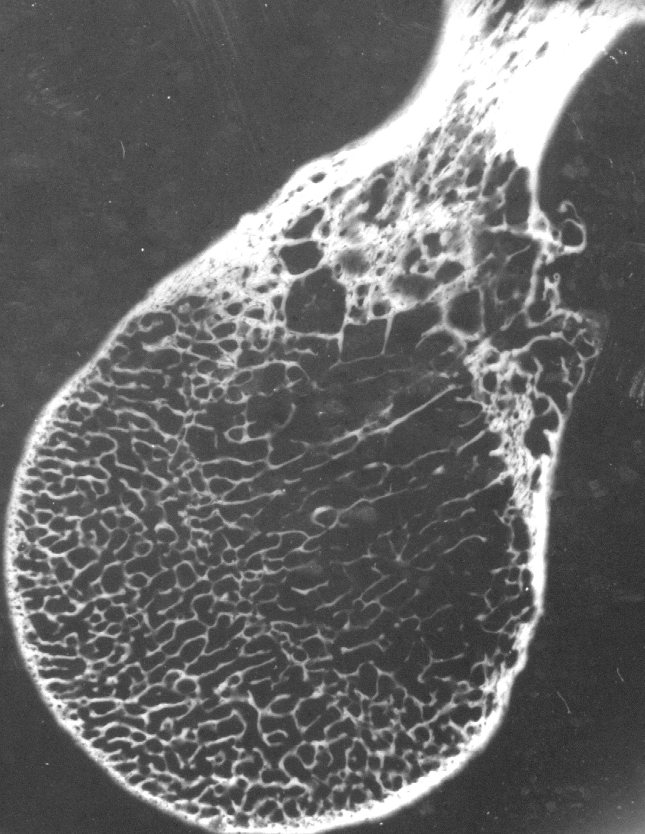 Photograph of bone cross section